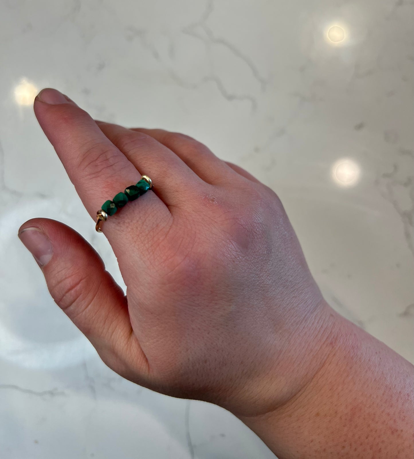 Malachite ring